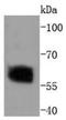 SMAD2 antibody, A00090S250, Boster Biological Technology, Western Blot image 
