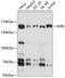Isoleucyl-TRNA Synthetase antibody, 13-488, ProSci, Western Blot image 