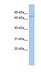 Peroxisomal Biogenesis Factor 5 antibody, NBP1-54585, Novus Biologicals, Western Blot image 