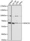 Histone deacetylase 10 antibody, STJ27945, St John