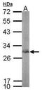 Bisphosphoglycerate mutase antibody, TA308853, Origene, Western Blot image 
