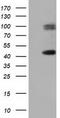 Haptoglobin antibody, TA501674AM, Origene, Western Blot image 