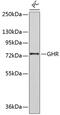 GHBP antibody, 18-881, ProSci, Western Blot image 
