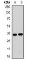 Tropomyosin 3 antibody, LS-B16058, Lifespan Biosciences, Western Blot image 