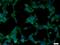 Exocyst Complex Component 6B antibody, 55440-1-AP, Proteintech Group, Immunofluorescence image 