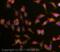 Carnitine Palmitoyltransferase 1C antibody, ab87498, Abcam, Immunocytochemistry image 