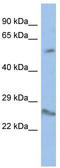 Homeobox protein VENTX antibody, TA339467, Origene, Western Blot image 