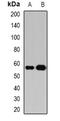 Amidophosphoribosyltransferase antibody, orb341152, Biorbyt, Western Blot image 