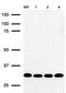 Replication Protein A2 antibody, NB100-158, Novus Biologicals, Western Blot image 