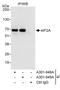 Eukaryotic Translation Initiation Factor 2A antibody, A301-949A, Bethyl Labs, Immunoprecipitation image 