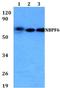 NBPF Member 6 antibody, GTX66863, GeneTex, Western Blot image 