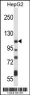 ATPase Plasma Membrane Ca2+ Transporting 4 antibody, 57-793, ProSci, Western Blot image 