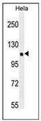 SIK Family Kinase 3 antibody, AP52341PU-N, Origene, Western Blot image 