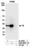 Thymidylate Synthetase antibody, A304-000A, Bethyl Labs, Immunoprecipitation image 