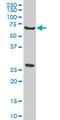 WASP Family Member 2 antibody, LS-C139315, Lifespan Biosciences, Western Blot image 
