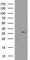 Nudix Hydrolase 6 antibody, LS-C172635, Lifespan Biosciences, Western Blot image 