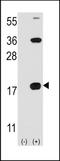 CD247 Molecule antibody, TA302187, Origene, Western Blot image 