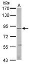 Eukaryotic Elongation Factor 2 Kinase antibody, TA308475, Origene, Western Blot image 