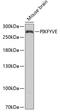 Phosphoinositide Kinase, FYVE-Type Zinc Finger Containing antibody, A02638-2, Boster Biological Technology, Western Blot image 
