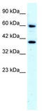 Nuclear receptor ROR-alpha antibody, TA330071, Origene, Western Blot image 
