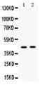 C-C Motif Chemokine Receptor 1 antibody, PB9991, Boster Biological Technology, Western Blot image 