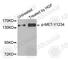 c-met antibody, AP0222, ABclonal Technology, Western Blot image 