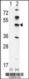 G Kinase Anchoring Protein 1 antibody, 61-941, ProSci, Western Blot image 