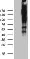 AT-Rich Interaction Domain 1A antibody, M00247, Boster Biological Technology, Western Blot image 