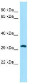 PIH1 Domain Containing 1 antibody, TA334347, Origene, Western Blot image 