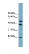 UFM1 Specific Peptidase 2 antibody, orb326165, Biorbyt, Western Blot image 