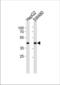 Alcohol Dehydrogenase 7 (Class IV), Mu Or Sigma Polypeptide antibody, TA325109, Origene, Western Blot image 