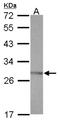 SSX Family Member 5 antibody, NBP2-20489, Novus Biologicals, Western Blot image 
