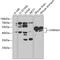 Cholinergic Receptor Nicotinic Alpha 5 Subunit antibody, GTX55490, GeneTex, Western Blot image 