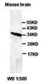 Chromosome 6 Open Reading Frame 47 antibody, orb77194, Biorbyt, Western Blot image 