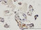 MAP kinase-interacting serine/threonine-protein kinase 1 antibody, LS-C133554, Lifespan Biosciences, Immunohistochemistry paraffin image 