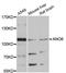 Anoctamin-6 antibody, LS-C747259, Lifespan Biosciences, Western Blot image 