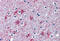 Purinergic Receptor P2X 7 antibody, MBS244892, MyBioSource, Immunohistochemistry frozen image 