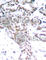 STAT3 antibody, AP0136, ABclonal Technology, Immunohistochemistry paraffin image 