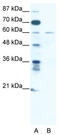 Zinc Finger Protein 92 antibody, TA341494, Origene, Western Blot image 