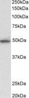 Mitogen-Activated Protein Kinase 9 antibody, MBS422715, MyBioSource, Western Blot image 