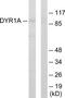 Dual Specificity Tyrosine Phosphorylation Regulated Kinase 1A antibody, TA313777, Origene, Western Blot image 
