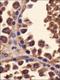 Y-Box Binding Protein 1 antibody, NBP1-97572, Novus Biologicals, Immunohistochemistry paraffin image 