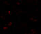 Laforin antibody, 7023, ProSci Inc, Immunofluorescence image 