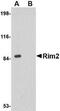 Regulating Synaptic Membrane Exocytosis 2 antibody, NBP1-76905, Novus Biologicals, Western Blot image 