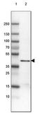 3-ketoacyl-CoA thiolase, peroxisomal antibody, NBP2-42380, Novus Biologicals, Western Blot image 