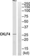 CKLF Like MARVEL Transmembrane Domain Containing 4 antibody, TA316145, Origene, Western Blot image 