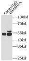 Ubiquitin-associated and SH3 domain-containing protein A antibody, FNab09150, FineTest, Immunoprecipitation image 