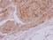 Lactate Dehydrogenase C antibody, NBP2-19321, Novus Biologicals, Immunohistochemistry paraffin image 