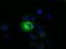 MAGUK p55 subfamily member 3 antibody, MA5-25146, Invitrogen Antibodies, Immunocytochemistry image 