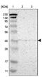 Cysteinyl Leukotriene Receptor 1 antibody, NBP1-85356, Novus Biologicals, Western Blot image 